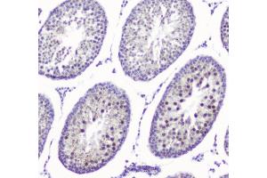 IHC analysis of SMC6L1 using anti-SMC6L1 antibody (ABIN5693133). (SMC6 Antikörper  (AA 205-443))