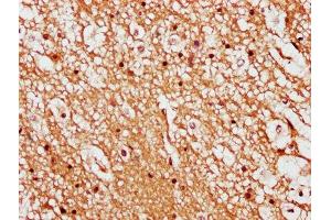 IHC image of ABIN7158375 diluted at 1:500 and staining in paraffin-embedded human brain tissue performed on a Leica BondTM system. (LIMD2 Antikörper  (AA 1-127))