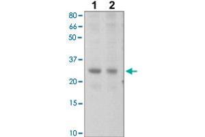 The tissue lysates derived from mouse liver (Lane 1), mouse muscle (Lane 2) were immunoprobed by SOCS2 polyclonal antibody  at 1 : 500. (SOCS2 Antikörper  (C-Term))