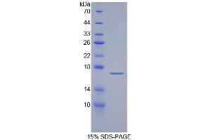 SDS-PAGE (SDS) image for alpha-2-Glycoprotein 1, Zinc-Binding (AZGP1) ELISA Kit (ABIN6720602)