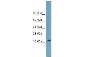 WB Suggested Anti-TRIM36 Antibody Titration:  0. (TRIM36 Antikörper  (Middle Region))