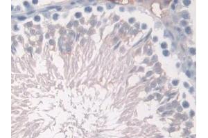 Immunohistochemistry (IHC) image for anti-Hemoglobin, alpha 1 (HBA1) (AA 1-142) antibody (ABIN7443962)