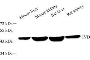 Western Blotting (WB) image for anti-Isovaleryl-CoA Dehydrogenase (IVD) antibody (ABIN7074382)