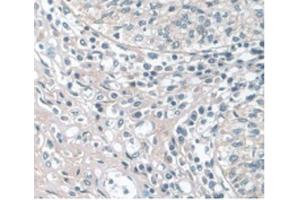 IHC-P analysis of Human Prostate Gland Tissue, with DAB staining. (APOA1 Antikörper  (AA 122-267))