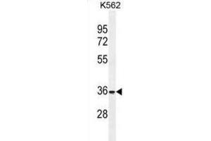 Western Blotting (WB) image for anti-Forkhead Box I3 (FOXI3) antibody (ABIN2996222) (FOXI3 Antikörper)