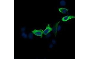 Image no. 3 for anti-Mitogen-Activated Protein Kinase Kinase 2 (MAP2K2) antibody (ABIN1499478) (MEK2 Antikörper)