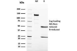 SDS-PAGE Analysis Purified MCM6 Mouse Monoclonal Antibody (MCM6/3000). (MCM6 Antikörper  (AA 228-368))