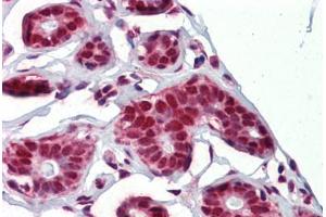 Human Breast (formalin-fixed, paraffin-embedded) stained with NKRF antibody ABIN462215 followed by biotinylated goat anti-rabbit IgG secondary antibody ABIN481713, alkaline phosphatase-streptavidin and chromogen. (NKRF Antikörper  (C-Term))