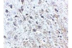 Immunohistochemistry of APP in mouse brain tissue with APP antibody at 2.