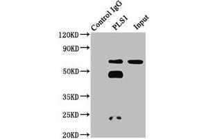 Immunoprecipitating PLS1 in 293 whole cell lysate Lane 1: Rabbit control IgG instead of ABIN7163552 in 293 whole cell lysate. (PLS1 Antikörper  (AA 1-143))