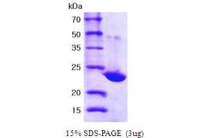 SDS-PAGE (SDS) image for Peroxiredoxin 1 (PRDX1) (AA 1-199) protein (His tag) (ABIN667075) (Peroxiredoxin 1 Protein (PRDX1) (AA 1-199) (His tag))