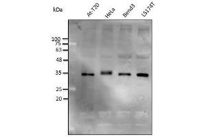 Anti-STUB1 Ab at 1/2,500 dilution, lysates at 50 µg per Iane, rabbit polyclonal to goat lgG (HRP) at 1/10,000 dilution, (STUB1 Antikörper)