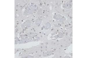 Immunohistochemistry of paraffin-embedded mouse brain using USP7/HAUSP antibody (ABIN6132280, ABIN6150032, ABIN6150034 and ABIN6217614) at dilution of 1:100 (40x lens). (USP7 Antikörper  (AA 206-1102))