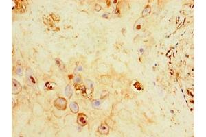 Immunohistochemistry of paraffin-embedded human placenta tissue using ABIN7175013 at dilution of 1:100