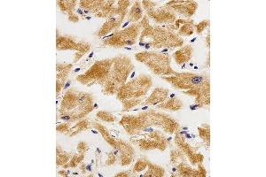 Immunohistochemical analysis of paraffin-embedded H. (AK4 Antikörper  (AA 119-153))