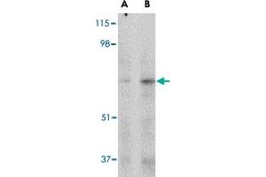 Western blot analysis of MAPKAP1 in human skeletal muscle tissue lysate with MAPKAP1 polyclonal antibody  at (A) 1 and (B) 2 ug/mL . (MAPKAP1 Antikörper  (Internal Region))