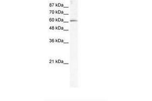 Image no. 1 for anti-Methyltransferase Like 3 (METTL3) (AA 206-255) antibody (ABIN202782) (METTL3 Antikörper  (AA 206-255))