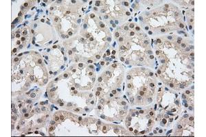 Image no. 12 for anti-Transforming, Acidic Coiled-Coil Containing Protein 3 (TACC3) antibody (ABIN1498097) (TACC3 Antikörper)