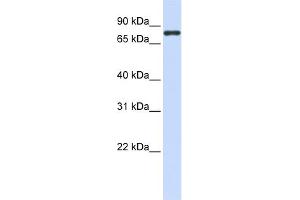WB Suggested Anti-ACP6 Antibody Titration:  0.