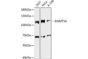 Western blot analysis of extracts of various cell lines, using DNMT3A antibody (ABIN6130284, ABIN6139747, ABIN6139749 and ABIN6215481) at 1:1000 dilution. (DNMT3A Antikörper  (AA 500-700))