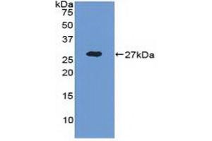 Detection of Recombinant ADAM17, Human using Polyclonal Antibody to A Disintegrin And Metalloprotease 17 (ADAM17) (ADAM17 Antikörper  (AA 226-473))