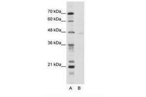 Image no. 1 for anti-Tripartite Motif Containing 38 (TRIM38) (N-Term) antibody (ABIN202589) (TRIM38 Antikörper  (N-Term))