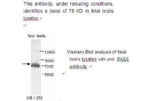 Image no. 1 for anti-P21-Activated Kinase 6 (PAK6) antibody (ABIN790802) (PAK6 Antikörper)