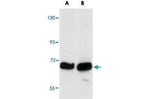 Western blot analysis of KLHL15 in HeLa cell lysate with KLHL15 polyclonal antibody  at (A) 1 and (B) 2 ug/mL . (KLHL15 Antikörper  (C-Term))