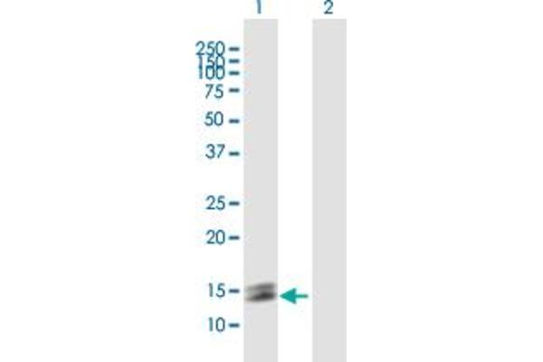 LY6D antibody  (AA 1-128)