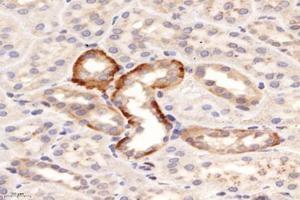 Immunohistochemistry (Paraffin-embedded Sections) (IHC (p)) image for anti-Proline-Rich Acidic Protein 1 (PRAP1) antibody (ABIN7075198)