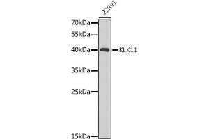 Western blot analysis of extracts of 22Rv1 cells, using KLK11 antibody (ABIN6129403, ABIN6142946, ABIN6142948 and ABIN6216242) at 1:1000 dilution. (Kallikrein 11 Antikörper  (AA 1-250))