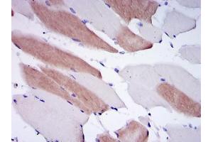 Immunohistochemical analysis of paraffin-embedded human striated muscle tissues using LMNA mouse mAb with DAB staining. (Lamin A/C Antikörper)