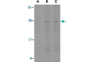 Western blot analysis of BID in A-549 cell lysates with BID polyclonal antibody  at (A) 0. (BID Antikörper  (Internal Region))