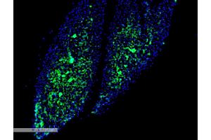 Immunohistochemistry analysis using Mouse Anti-Thyroid Hormone Receptor Monoclonal Antibody, Clone H43 (ABIN6952053). (THRA Antikörper  (Biotin))