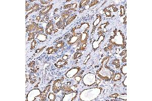 IHC analysis of Cytokeratin 4/KRT4 using anti-Cytokeratin 4/KRT4 antibody (ABIN7600283).