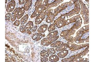 IHC-P Image PKD2 antibody [C1C3] detects PKD2 protein at cytosol and membrane on mouse intestine by immunohistochemical analysis.