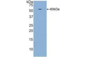 Detection of Recombinant ITGb1, Human using Polyclonal Antibody to Integrin Beta 1 (ITGb1) (ITGB1 Antikörper  (AA 140-383))