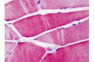 Human Skeletal Muscle: Formalin-Fixed, Paraffin-Embedded (FFPE) (ACTN3 Antikörper  (N-Term))