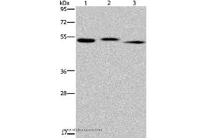 Western blot analysis of Human kidney tissue, HepG2 cell and human testis tissue, using HYAL3 Polyclonal Antibody at dilution of 1:400 (HYAL3 Antikörper)