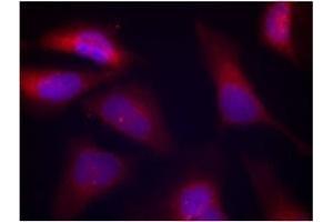 Image no. 3 for anti-Eukaryotic Translation Initiation Factor 2-alpha Kinase 2 (EIF2AK2) (pThr446) antibody (ABIN197048) (EIF2AK2 Antikörper  (pThr446))