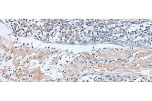 Immunohistochemistry of paraffin-embedded Human tonsil tissue using ABR Polyclonal Antibody at dilution of 1:50(x200) (ABR Antikörper)