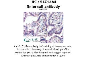 Image no. 1 for anti-Solute Carrier Family 12 (Potassium-Chloride Transporter) Member 4 (SLC12A4) (Internal Region) antibody (ABIN1739330)