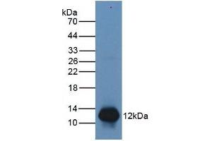 Mouse Capture antibody from the kit in WB with Positive Control: Human Lymphocyte lysate.