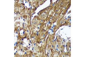 Immunohistochemistry of paraffin-embedded Mouse heart using [KO Validated] NSDHL Rabbit pAb (ABIN7268794) at dilution of 1:100 (40x lens). (NSDHL Antikörper  (AA 1-240))