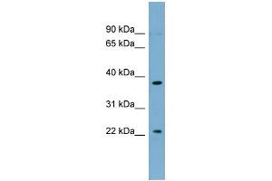 WB Suggested Anti-FOXN4 Antibody Titration:  0. (FOXN4 Antikörper  (Middle Region))