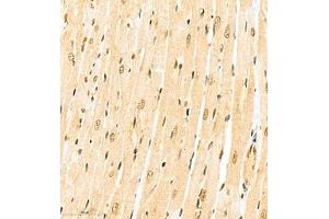 Immunohistochemistry (Paraffin-embedded Sections) (IHC (p)) image for anti-Cbp/p300-Interacting Transactivator, with Glu/Asp-Rich Carboxy-terminal Domain, 4 (CITED4) antibody (ABIN7073356)