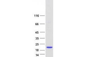 Validation with Western Blot (CUTA Protein (Transcript Variant 4) (Myc-DYKDDDDK Tag))