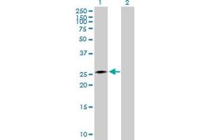 Western Blotting (WB) image for CIDEA 293T Cell Transient Overexpression Lysate(Denatured) (ABIN1331356)