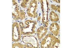 Immunohistochemistry of paraffin-embedded human kidney using RAB1B antibody at dilution of 1:100 (x400 lens).