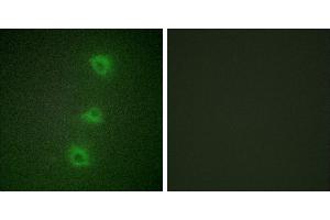 Peptide - +Immunofluorescence analysis of HUVEC cells, using B-RAF antibody. (SNRPE Antikörper  (Internal Region))